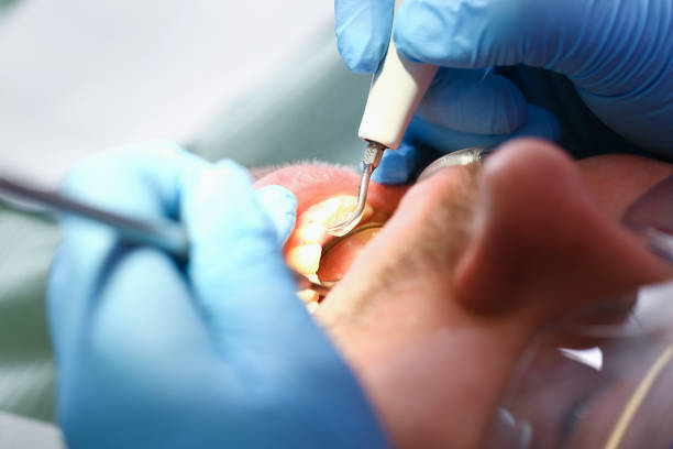 Best Walk-In Emergency Dentist in Cotati, CA